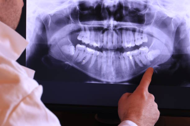 Best Emergency Treatment for Toothache in Yukon, OK