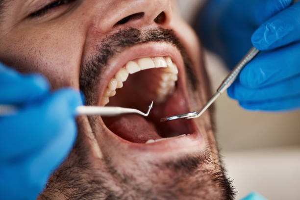 Best Weekend Emergency Dentist in Yukon, OK