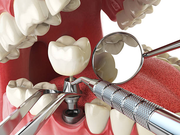 Best Walk-In Emergency Dentist in Yukon, OK
